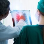 Best Hospitals For Esophageal Cancer